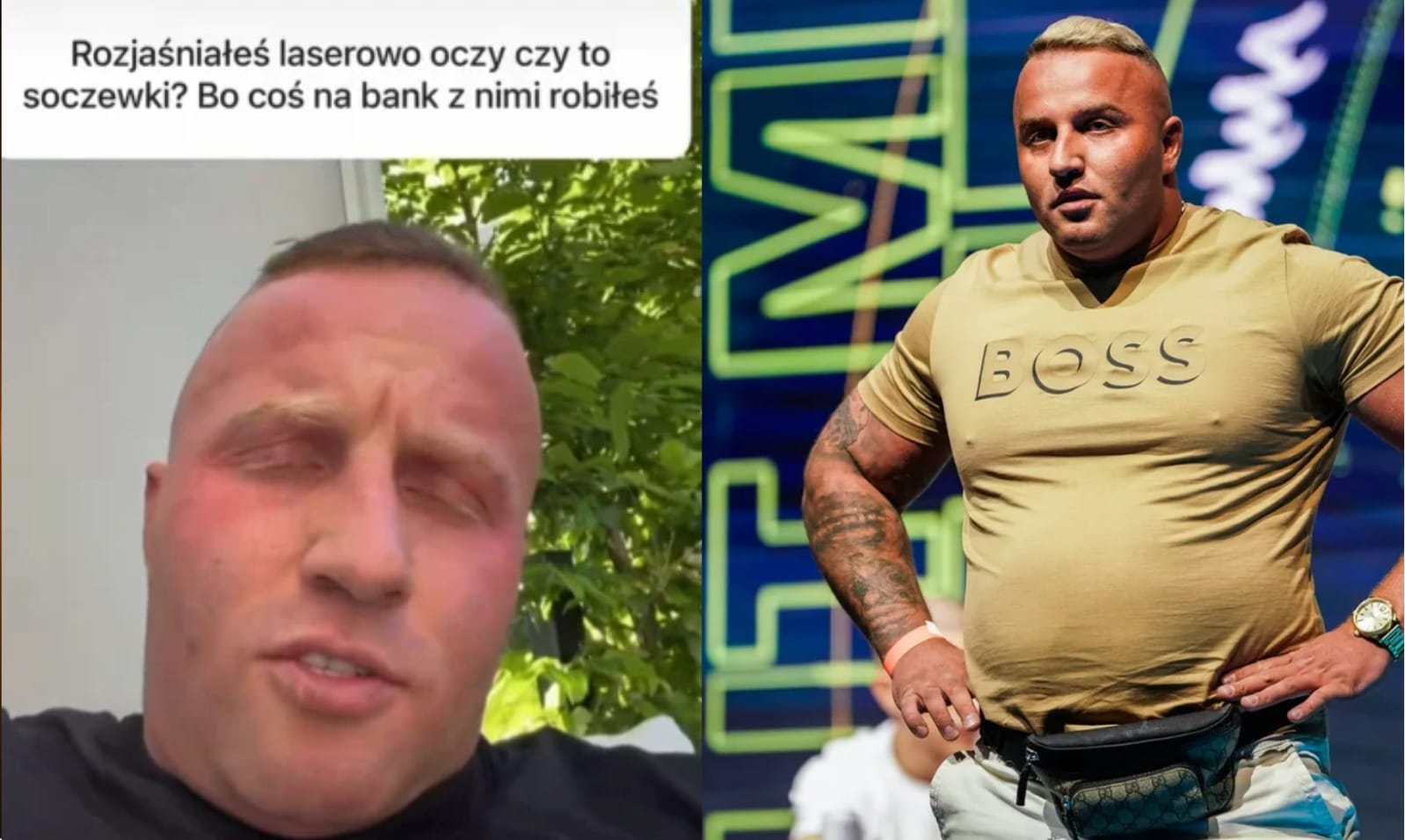 To są moje oczy, stać mnie było, to sobie zrobiłem. Denis Załęcki o laserowym rozjaśnieniu oczu Zdjęcie wpisu