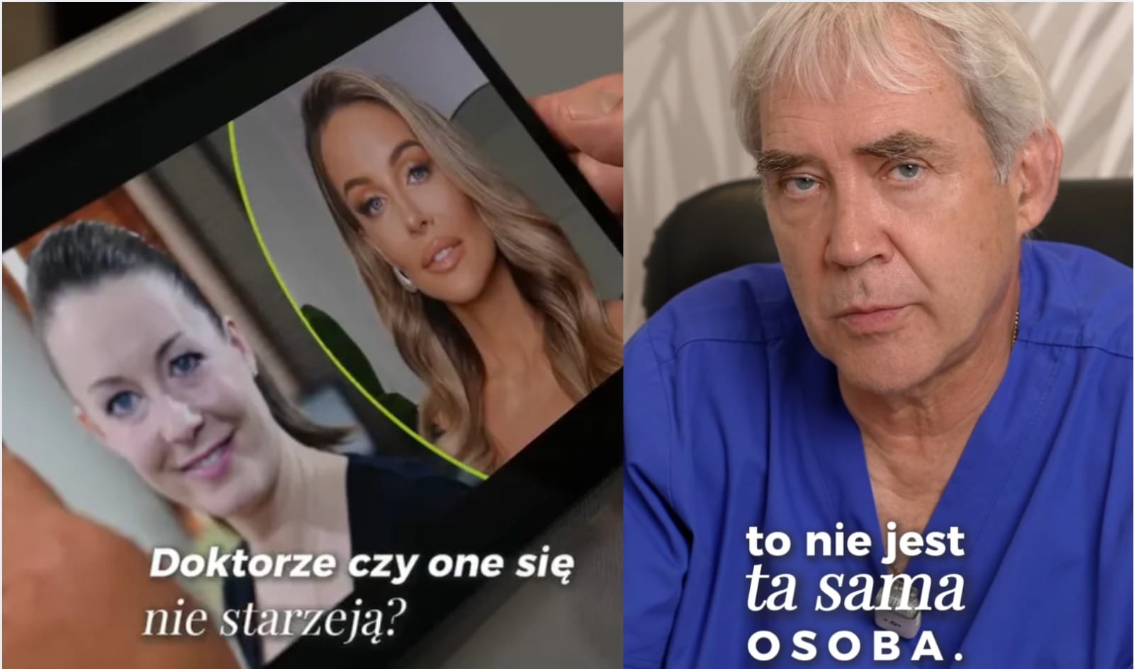 „To nie ta sama osoba”. Lekarz ocenił twarz Małgorzaty Rozenek po zabiegach Zdjęcie wpisu