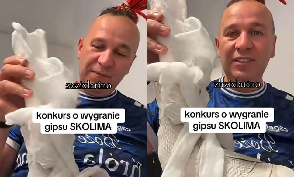 Gratka dla fanów Skolima. Ogłoszono konkurs w którym do wygrania jest jego gips Zdjęcie wpisu