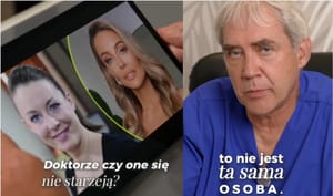 „To nie ta sama osoba”. Lekarz ocenił twarz Małgorzaty Rozenek po zabiegach