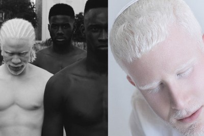 17 zdjęć ludzi dotkniętych albinizmem! Wyglądają jak duchy, aż ciężko uwierzyć, że to nie przeróbki!