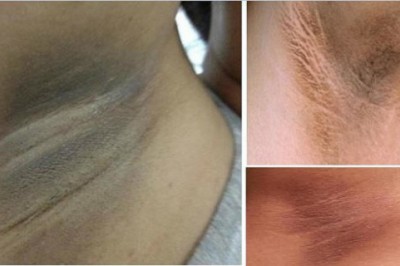 7 prostych sposobów by pozbyć się 