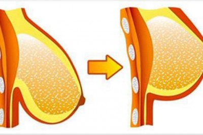 7 ćwiczeń które skutecznie w naturalny sposób podniosą Twoje piersi! Zrobisz to bez operacji! 