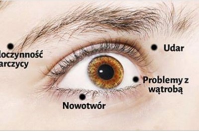 8 ostrzeżeń o stanie Twojego zdrowia, które możesz wyczytać ze swoich oczu! Zwróć uwagę na to! 