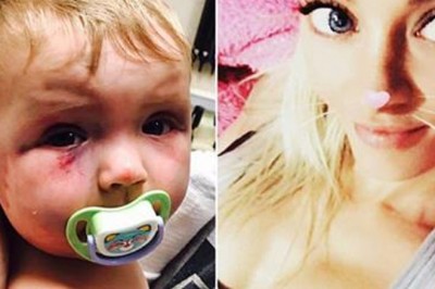 Brutalnie pobiła swoją 8 miesięczną córeczkę! Jednak sąd uznał że obrażenia nie są trwałe i ją wypuścił!