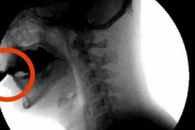 Będziesz w szoku gdy dowiesz się co się dzieje w twoim organizmie 60 minut po wypiciu coli! 