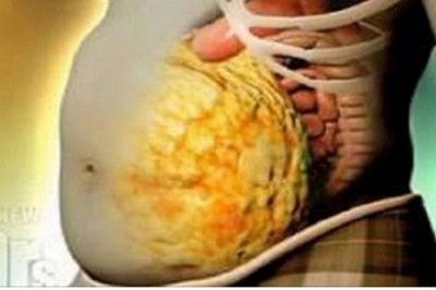 Chcesz przyspieszyć metabolizm i pozbyć się toksyn z organizmu? Ta prosta receptura daje efekt w 72h! 