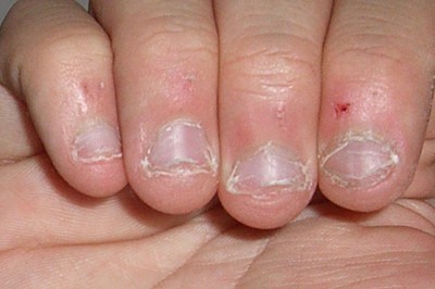 Ciągle obgryzasz paznokcie? Zobacz jak świadczy to o Twojej osobowości i pewnych cechach charakteru!