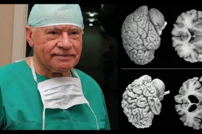 Dowiedz się o nieznanych faktach na temat mózgu kobiety! Zrozumiesz czym różni się od mężczyzny! 