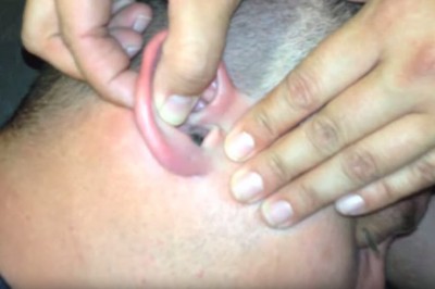 Facet czuł ostry ból w uchu. To co tam znaleziono odbiera apetyt! 