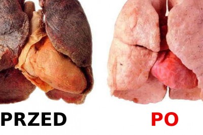 Jeśli jesteś palaczem pij to codziennie! Zobacz przepis na napój który pomoże oczyścić Twoje płuca! 