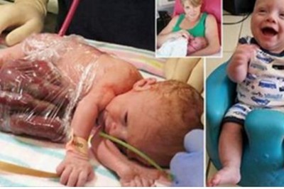 Lekarz namawia ja na aborcję widząc stan płodu! Dzielna mama powiedziała NIE i doprowadziła do cudu!