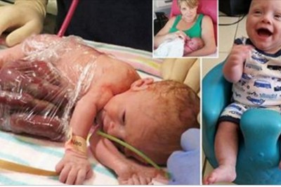 Lekarz namawiał ja na aborcję widząc stan płodu! Dzielna mama powiedziała NIE i doprowadziła do cudu!