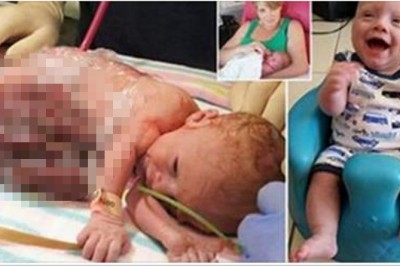 Lekarz przekonywał Ją do aborcję widząc stan płodu! Mama powiedziała NIE i doprowadziła do cudu!