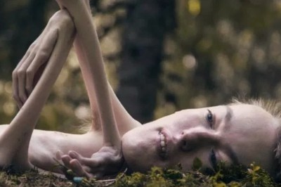 Lekarze nie dawali mu szans na normalne życie. 30 lat temu w sieci pojawiły się te zdjęcia! 