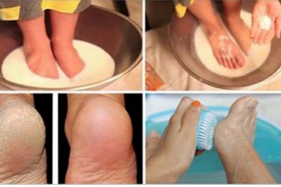 Nie trać więcej pieniędzy na pedikiur! 2 składniki które masz w kuchni sprawią, że stopy wyglądają cudnie!