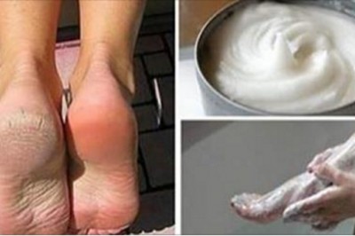 Nigdy więcej popękanych pięt! Tania mikstura którą wykonasz sama w domu zdziała cuda!        