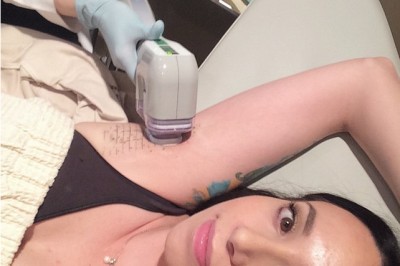 Nowatorska metoda usuwania owłosienia! Zdecydowałabyś się? 