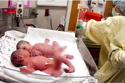 Nowo narodzone bliźniaki płakały dopóki lekarz nie położył ich razem! Wtedy stało się TO!  