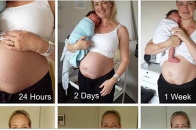 Odważna mama pokazuje zdjęcia brzucha dzień po porodzie! 14 tygodni później zupełnie się zmienia!