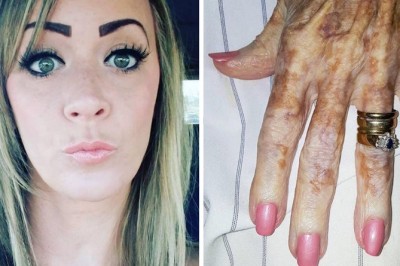 Pielęgniarka z domu opieki wrzuciła zdjęcie dłoni jednej z chorych! Historia która za tym stoi chwyta za serce! 