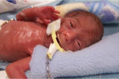 Pielęgniarka zrobiła zdjęcie gdy maluszek otworzył oczy! Rok później zdarzył się ten cudowny moment!