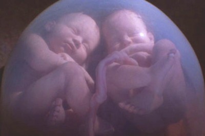 Podczas badania brzuszka mamy uchwycili coś niesamowitego! Zobacz bliźniaków walczących o miejsce!