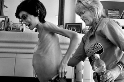 Pomaga umierającemu synowi przymierzyć ubrania na własny pogrzeb! Wie, że jego koniec jest bliski! 