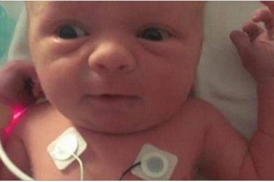 Rodzice byli przygotowani na najgorsze po rozmowie z lekarzem! Podczas porodu przeżyli cud! 