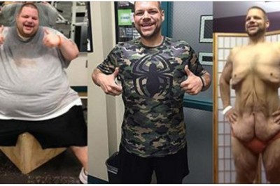 Stracił 190 kg w 714 dni! Dzięki ciężkiej pracy osiągnął coś niesamowitego ale zobacz jego skórę!