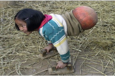 Szokująca historia dziewczynki zwanej 