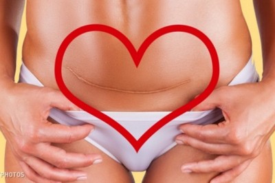 Trzy prawdy o cesarskim cięciu które powinna poznać kobieta! To wymaga więcej odwagi niż myślisz!