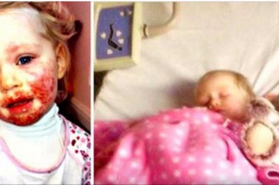 Twarz tej dziewczynki zmieniła się w krwawiącą plamę! Wystarczył jeden pocałunek cioci! 