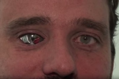 W miejsce straconego oka wstawił kamerę. Teraz nagrywa wszystko co widzi! 