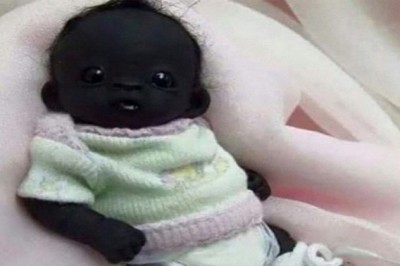 Wielu myślało, że jego zdjęcie to oszustwo. Poznajcie dziecko z najczarniejszą skórą! 