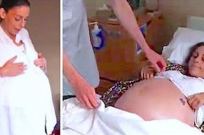 Wszyscy sądzili że ta 35 letnia alkoholiczka jest w ciąży! Ale to nie dziecko było w jej ogromnym brzuchu!