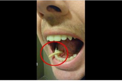 Wydawało mu się, że ma kamyk pod językiem! Gdy zaczął to wypychać byłam przerażona!