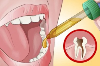 Zobacz naturalną metodę na pozbycie się ostrego bólu zęba! Nawet mój dentysta był zaskoczony! 