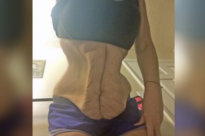 Zdjęcie brzucha tej kobiety szokowało wszystkich! W końcu postanowiła podzielić się prawdą!