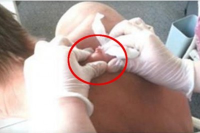 Jak zaczął wyciskać tego pryszcza zrobiło mi się niedobrze! Będzie ciężko obejrzeć do końca!