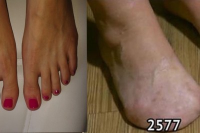 12 części ludzkiego ciała które zanikną w przyszłości! Wszystko z powodu ewolucji! 