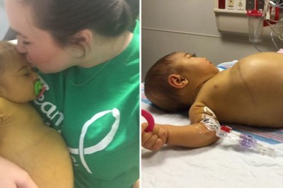 Jej brzuch od urodzenia nie przestawał rosnąć! Kiedy lekarze zrozumieli co się dzieje, wpadli w panikę!