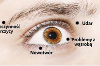 8 ostrzeżeń o stanie Twojego zdrowia, które możesz wyczytać ze swoich oczu! Zwróć na to uwagę!