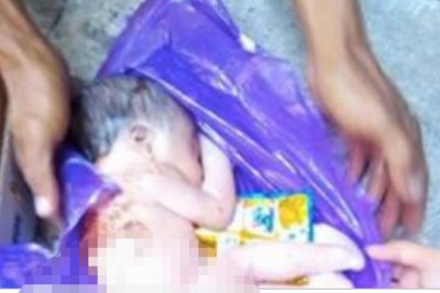 Kobieta znajduje porzucone dziecko w swoim koszu na śmieci! Było w opłakanym stanie! 