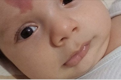 Gdy położna zobaczyła znamię z jakim się urodził zaniemówiła! Rodzice nie mogli powstrzymać łez!