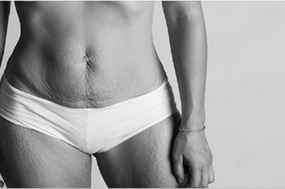 Robi zdjęcia mam po porodzie, żeby pokazać jak naprawdę wyglądają ich ciała! 