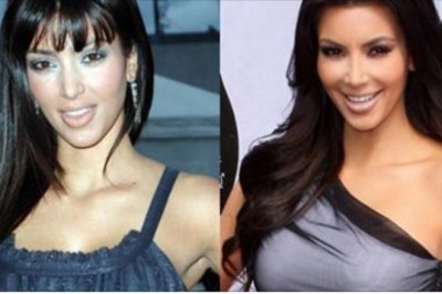  11 celebrytów przed i po ingerencji chirurgów plastycznych!. Zobacz jak można kupić piękno!