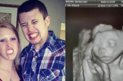 Zdecydowała się na terapię hormonalną żeby zajść w ciążę! Podczas USG lekarz widzi coś zaskakującego! 