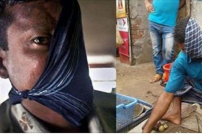 20 lat temu tygrys okaleczył mu twarz! Po latach odważył się pokazać publicznie jak wygląda!