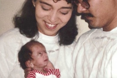 Ludzie śmiali się  wyglądu twarzy małej dziewczynki! Zobacz jak wygląda 25 lat później gdy wszystkich uciszyła! 